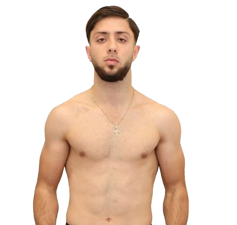 Giangreco